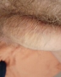 photo-thumb