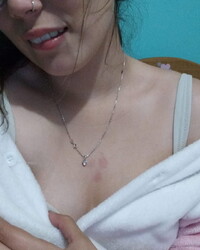 photo-thumb