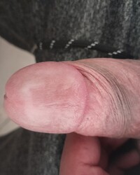 album-cover