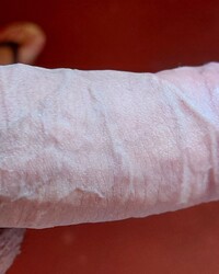 photo-thumb