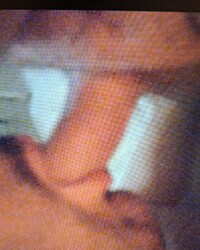 photo-thumb