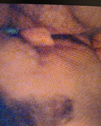 photo-thumb