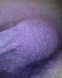 photo-thumb