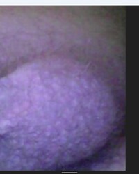 photo-thumb