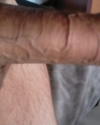 photo-thumb