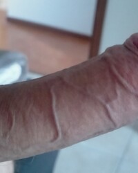 photo-thumb