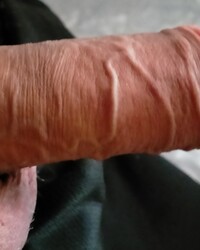 photo-thumb