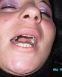 photo-thumb