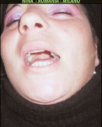 photo-thumb