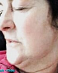 photo-thumb