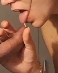 photo-thumb