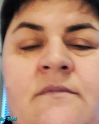 photo-thumb