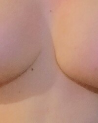 photo-thumb