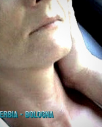 photo-thumb