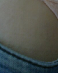 photo-thumb