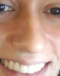 photo-thumb