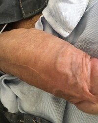photo-thumb
