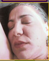 photo-thumb