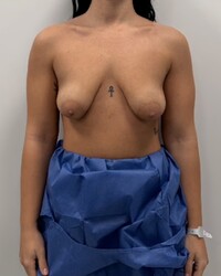 photo-thumb
