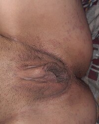 photo-thumb