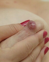photo-thumb