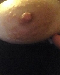 photo-thumb