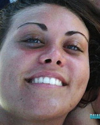 photo-thumb