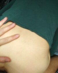 photo-thumb