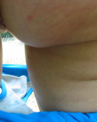 photo-thumb