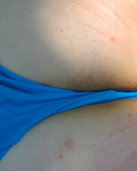 photo-thumb