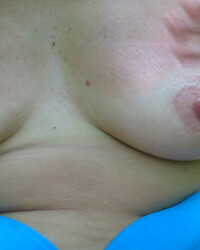 photo-thumb