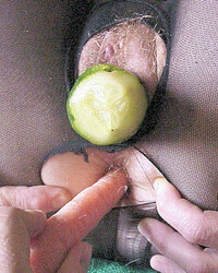 photo-thumb