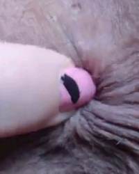 photo-thumb