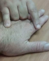 photo-thumb