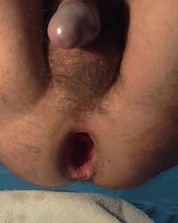 photo-thumb