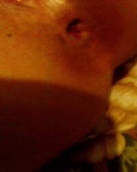 photo-thumb