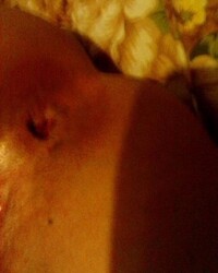 photo-thumb