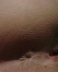 photo-thumb