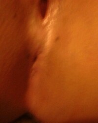 photo-thumb