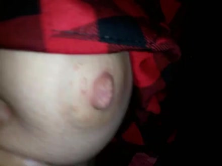 Thumb 6