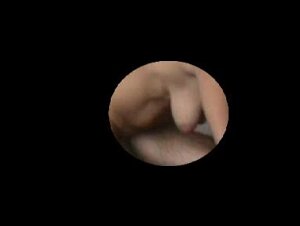 Thumb 7