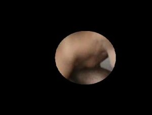 Thumb 8