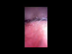 Thumb 8