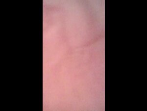 Thumb 8
