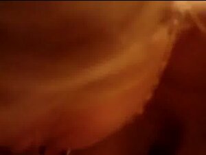 Thumb 8