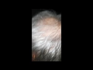 Thumb 7